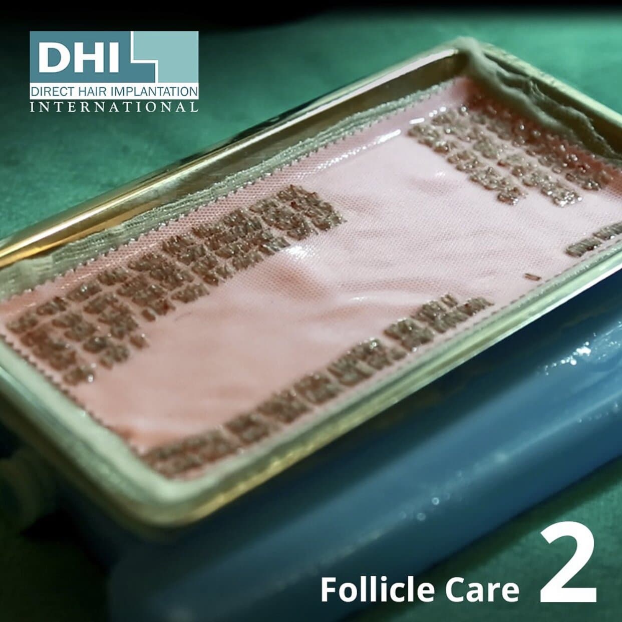 dhi hair transplant process 2 follicle care